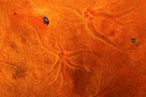 Spugna rossa (Spirastrella cunctatrix)