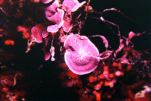 Alga calcarea (Lithophyllum stictaeforme)