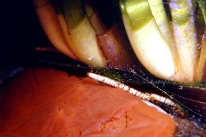 Posidonia (Posidonia oceanica)