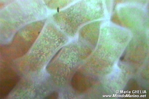 Casside (Phalium granulatum)
